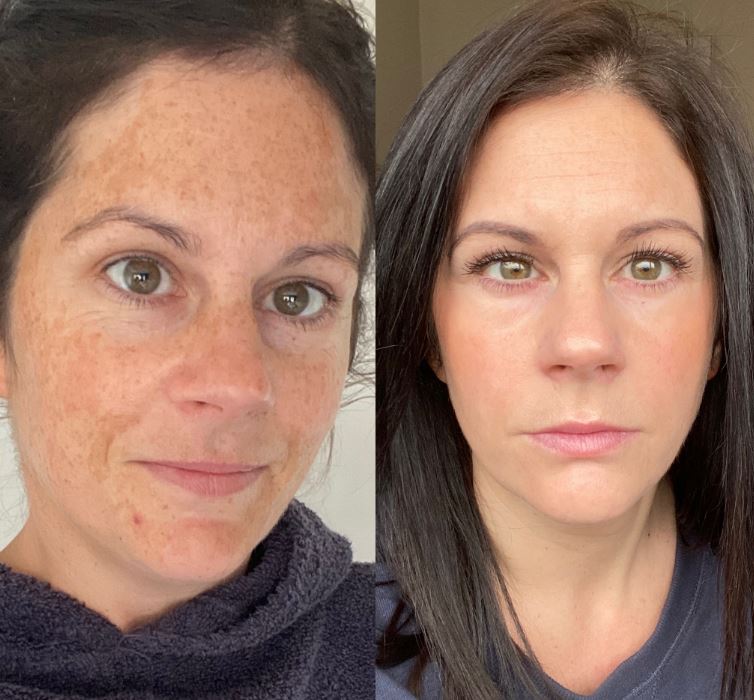 Almohadillas Limpiadoras con Ácido Kójico y Cúrcuma – Exfoliación Suave y Luminosidad Natural