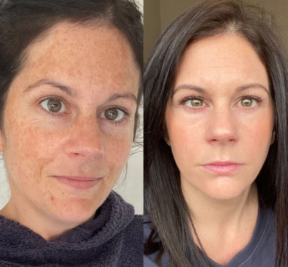 Almohadillas Limpiadoras con Ácido Kójico y Cúrcuma – Exfoliación Suave y Luminosidad Natural