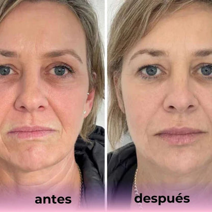 Mascarilla de Bio-Colágeno – Piel firme y radiante al instante