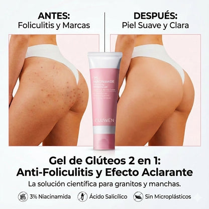 Gluwen - Gel de Glúteos 2 en 1: Anti-Foliculitis y Efecto Aclarante