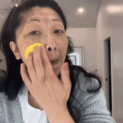 Almohadillas Limpiadoras con Ácido Kójico y Cúrcuma – Exfoliación Suave y Luminosidad Natural